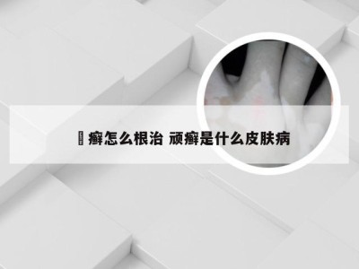 頑癣怎么根治 顽癣是什么皮肤病