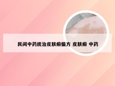 民间中药统治皮肤癣偏方 皮肤癣 中药