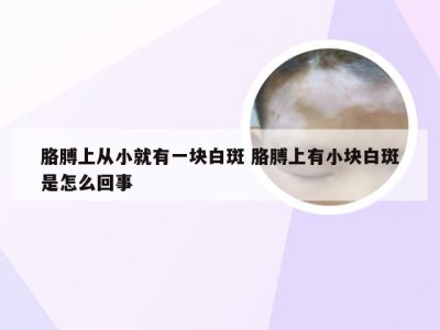 胳膊上从小就有一块白斑 胳膊上有小块白斑是怎么回事