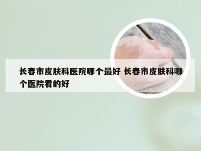 长春市皮肤科医院哪个最好 长春市皮肤科哪个医院看的好