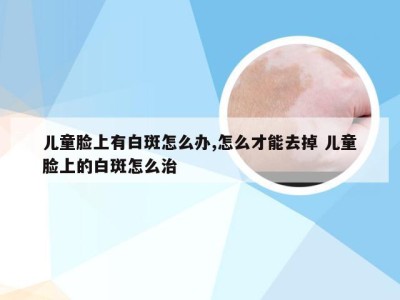 儿童脸上有白斑怎么办,怎么才能去掉 儿童脸上的白斑怎么治