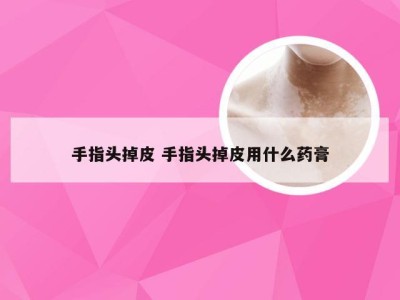 手指头掉皮 手指头掉皮用什么药膏