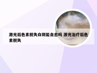 激光后色素脱失白斑能自愈吗 激光治疗后色素脱失