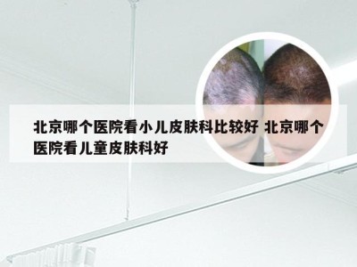 北京哪个医院看小儿皮肤科比较好 北京哪个医院看儿童皮肤科好