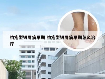 脓疱型银屑病早期 脓疱型银屑病早期怎么治疗