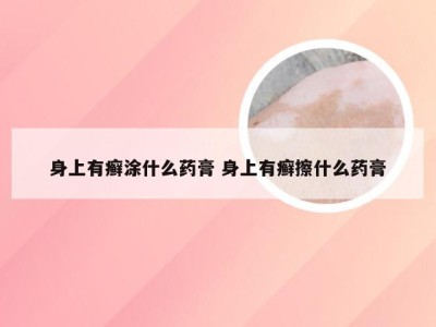 身上有癣涂什么药膏 身上有癣擦什么药膏