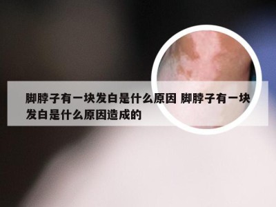 脚脖子有一块发白是什么原因 脚脖子有一块发白是什么原因造成的