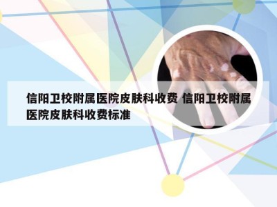 信阳卫校附属医院皮肤科收费 信阳卫校附属医院皮肤科收费标准