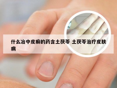 什么冶中皮癣的药含土茯苓 土茯苓治疗皮肤病