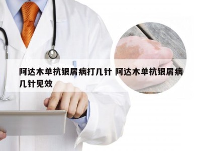 阿达木单抗银屑病打几针 阿达木单抗银屑病几针见效