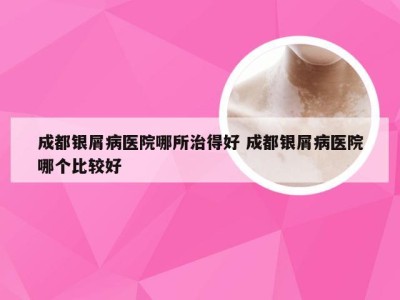 成都银屑病医院哪所治得好 成都银屑病医院哪个比较好