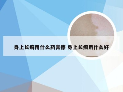 身上长癣用什么药膏擦 身上长癣用什么好