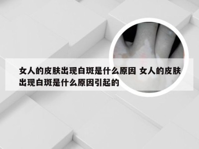 女人的皮肤出现白斑是什么原因 女人的皮肤出现白斑是什么原因引起的