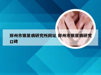 郑州市银屑病研究所网址 郑州市银屑病研究口碑