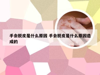 手会脱皮是什么原因 手会脱皮是什么原因造成的