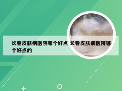 长春皮肤病医院哪个好点 长春皮肤病医院哪个好点的