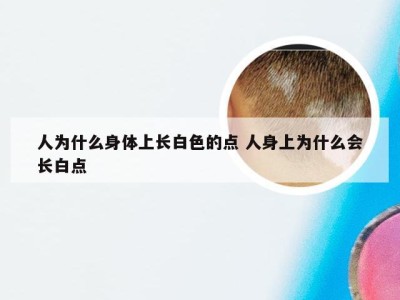 人为什么身体上长白色的点 人身上为什么会长白点