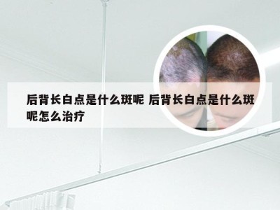 后背长白点是什么斑呢 后背长白点是什么斑呢怎么治疗