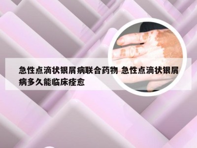 急性点滴状银屑病联合药物 急性点滴状银屑病多久能临床痊愈