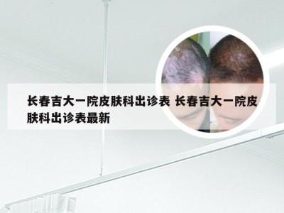 长春吉大一院皮肤科出诊表 长春吉大一院皮肤科出诊表最新