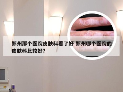 郑州那个医院皮肤科看了好 郑州哪个医院的皮肤科比较好?