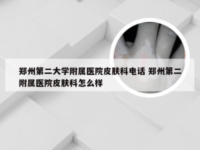 郑州第二大学附属医院皮肤科电话 郑州第二附属医院皮肤科怎么样