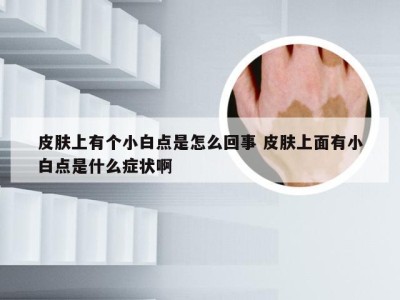 皮肤上有个小白点是怎么回事 皮肤上面有小白点是什么症状啊