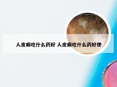 人皮癣吃什么药好 人皮癣吃什么药好使