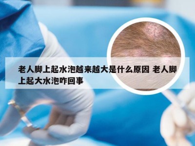 老人脚上起水泡越来越大是什么原因 老人脚上起大水泡咋回事