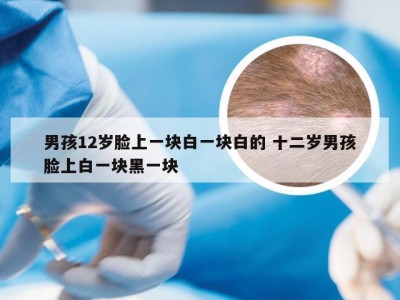 男孩12岁脸上一块白一块白的 十二岁男孩脸上白一块黑一块