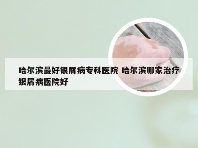 哈尔滨最好银屑病专科医院 哈尔滨哪家治疗银屑病医院好