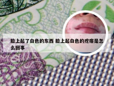 脸上起了白色的东西 脸上起白色的疙瘩是怎么回事