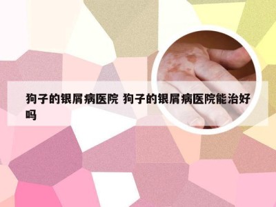 狗子的银屑病医院 狗子的银屑病医院能治好吗