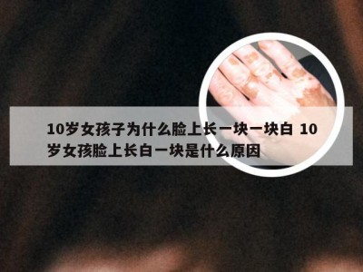 10岁女孩子为什么脸上长一块一块白 10岁女孩脸上长白一块是什么原因