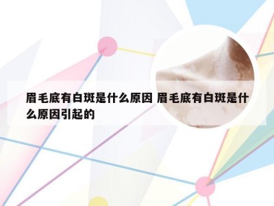 眉毛底有白斑是什么原因 眉毛底有白斑是什么原因引起的