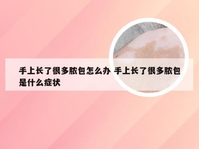 手上长了很多脓包怎么办 手上长了很多脓包是什么症状