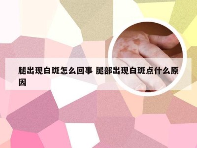 腿出现白斑怎么回事 腿部出现白斑点什么原因