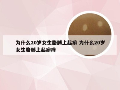 为什么20岁女生胳膊上起癣 为什么20岁女生胳膊上起癣痒