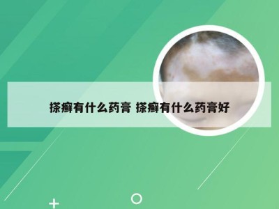 搽癣有什么药膏 搽癣有什么药膏好