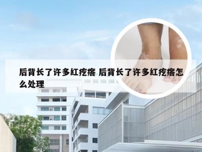 后背长了许多红疙瘩 后背长了许多红疙瘩怎么处理