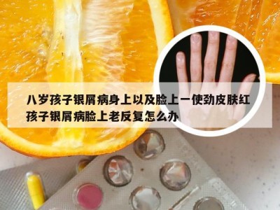 八岁孩子银屑病身上以及脸上一使劲皮肤红 孩子银屑病脸上老反复怎么办