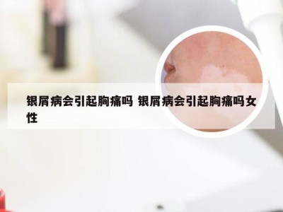 银屑病会引起胸痛吗 银屑病会引起胸痛吗女性