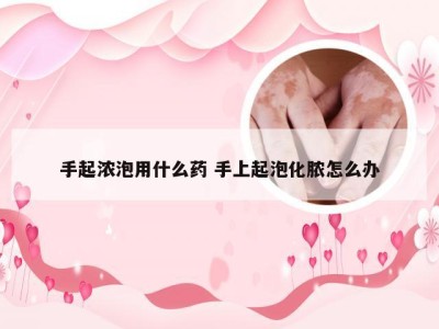 手起浓泡用什么药 手上起泡化脓怎么办