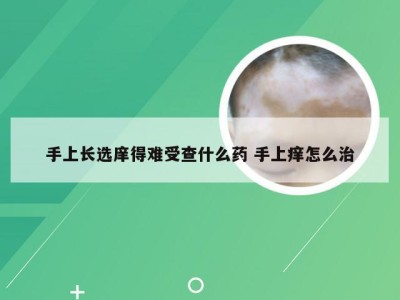 手上长选庠得难受查什么药 手上痒怎么治