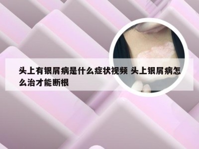 头上有银屑病是什么症状视频 头上银屑病怎么治才能断根