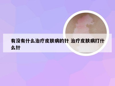 有没有什么治疗皮肤病的针 治疗皮肤病打什么针