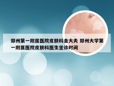 郑州第一附属医院皮肤科金大夫 郑州大学第一附属医院皮肤科医生坐诊时间