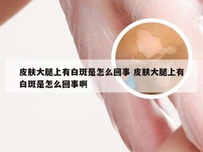 皮肤大腿上有白斑是怎么回事 皮肤大腿上有白斑是怎么回事啊