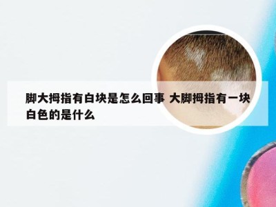 脚大拇指有白块是怎么回事 大脚拇指有一块白色的是什么