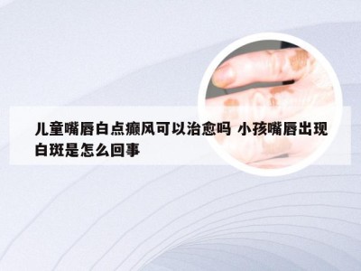 儿童嘴唇白点癫风可以治愈吗 小孩嘴唇出现白斑是怎么回事